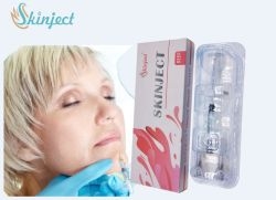 สายหน้า / จมูก / ริมฝีปาก / ช่องคอ Hyaluronic Acid Dermal Filler ด้วยอายุการใช้งาน 2 ปี
