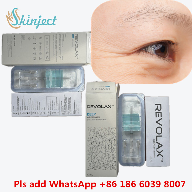 สารเติมผิวหนัง จับฝีปาก สะอาด HA Cross Linked 1ml สารเติมผิวหนังลึกสําหรับจับจมูก