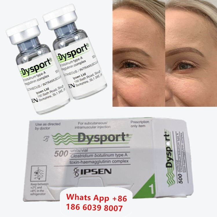 โบทูลินัม ท็อกซิน ชนิด A สำหรับริ้วรอยใต้ตา (Dysport)