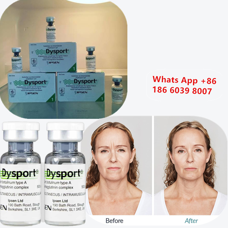 โบตูลินูม ท็อกซิน ประเภท A การฉีด Dysport เพื่อลดรอยเหี่ยว