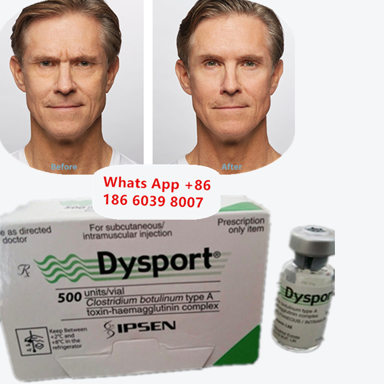 ผงแช่แข็งลดเลือนริ้วรอย Dysport Botulinum Toxin Type A