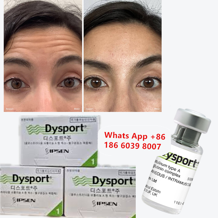 Botulinum Toxin Dysport Anti-wrinkle Powder ที่แห้งด้วยน้ําแข็ง สําหรับการลดน้ําหนักหน้า