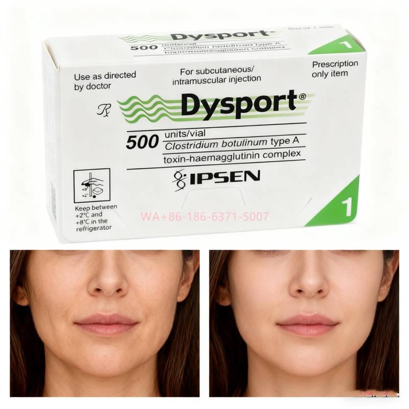 โบทูลินัม ท็อกซิน 500U Dysport ลดเลือนริ้วรอยบนใบหน้าและฟื้นฟูผิวให้เรียบเนียน