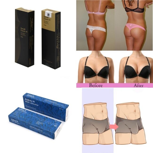 10 มิลลิลิตร 20 มิลลิลิตร เติมกรดไฮยอลูรอนิคบริสุทธิ์ สําหรับการขยายหน้าอกและกระโปรง