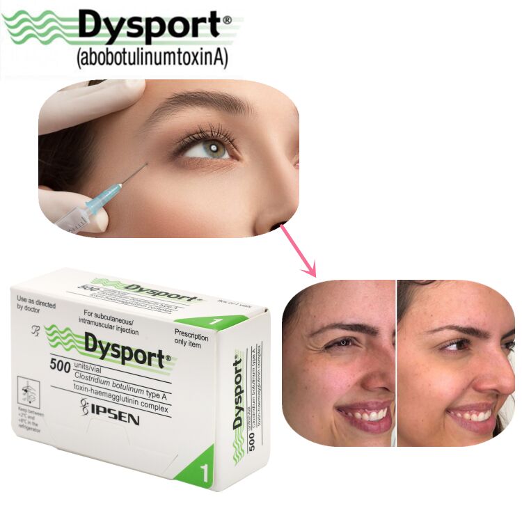 500u Dysport ลดริ้วรอยบนใบหน้า การแปรรูปปูนแห้งแบบเย็น Custom OEM Dysport