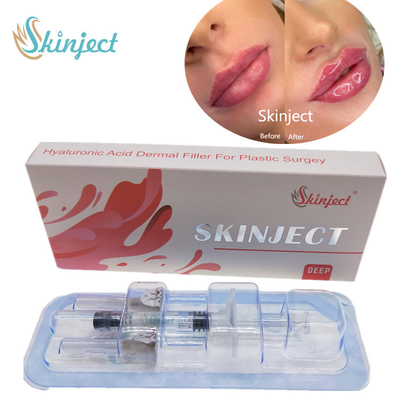 Skinject Deep Hyaluronic Acid Dermal 2ml ฟิลเลอร์ริมฝีปาก Injectable