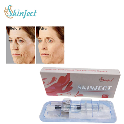 ฉีดฟิลเลอร์ริมฝีปากลึกสำหรับริ้วรอยบนใบหน้าลึกและพับ
