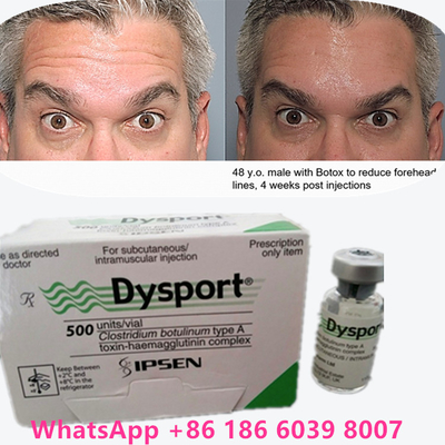 โบตูลินัม ท็อกซิน โบโต็กซ์ พาวเดอร์ ดิสปอร์ต 100 ยู / 1 ถังสําหรับผิวที่แก่