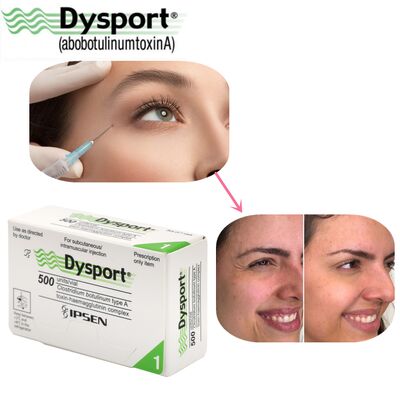 500u Dysport ลดริ้วรอยบนใบหน้า การแปรรูปปูนแห้งแบบเย็น Custom OEM Dysport